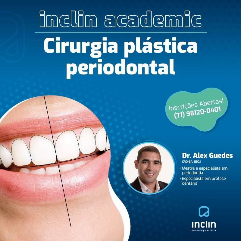 Cirurgia Plastica Periodental