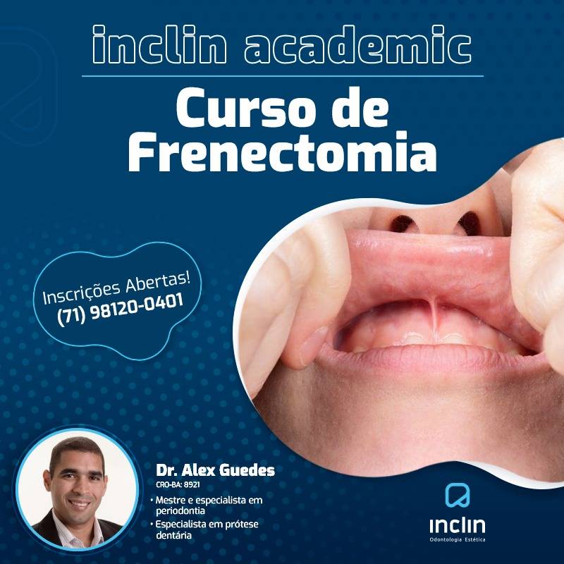 Curso de Frenectomia