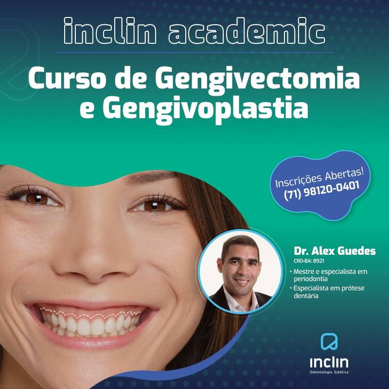 Curso de Gengivectomia e Gengivoplastia