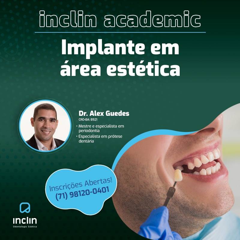 Curso de Implante em Area Tecnica